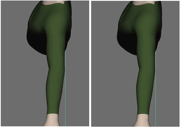 genericElbow2